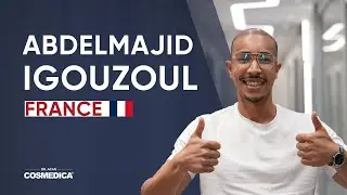 Abdelmajid Igouzoul Hair Transplant Review | Dr. Acar | Cosmedica Clinic