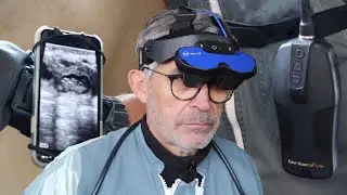 Easi-Scan:Go Lite ultrasound scanner