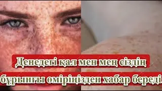 Денедегі қал мен мең сіздің бұрынғы өміріңізден хабар береді