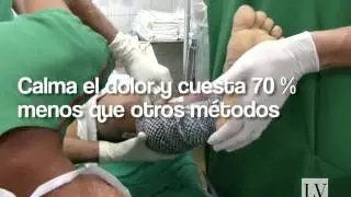 Tratan quemaduras con piel de tilapia