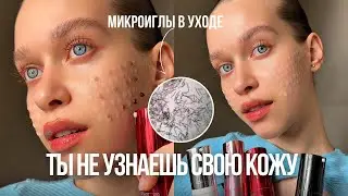 МОЙ УХОД ЗА КОЖЕЙ✨ по этапам | спикулы, микроиглы, как ухаживать за кожей