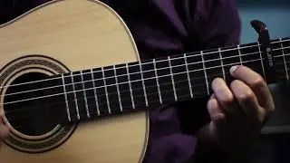 KIMIK - VIXIARSKI BALET (ACOUSTIC)