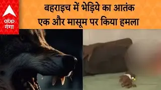 Bhediya Attack in Behraich: बहराइच से बड़ी खबर, बीती रात भेड़िये ने मासूम पर किया हमला
