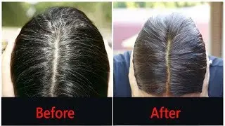 Gray Hair Remedy - Turn White or Gray Hair to Black Naturally Using Only 2 Ingredients!