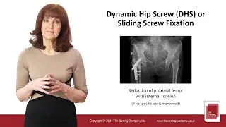 Training Video: Dynamic Hip Screw Fixation