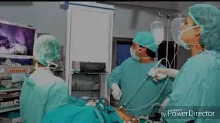 Mioma olib tashlangandan keyingi hayot