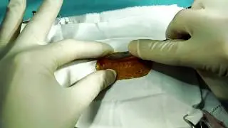 Rules of skin disconnection