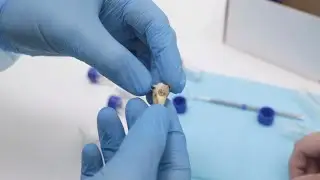 История удаленных зубов. 