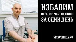 Избавим от "косточки" на стопе за один день!