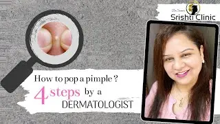 HOW TO POP A PIMPLE | 4 easy steps by SKIN Dr SONAM | CLEAN Zit popping | blackheads and whiteheads