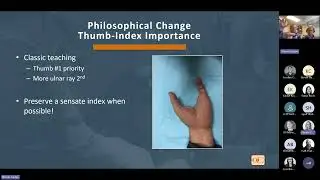 Webinar: Upper Extremity Novel Muscle Transfer for Independent Prosthetic Digit Control