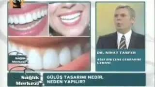 Gülüş tasarımı nedir , neden yapılır - Tanfer Klinik