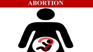Abortion  Part -1   Theory and multiple Choice Questions...