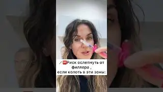 От этих инъекций филлера  ослепнуть #омоложение #косметология #морщины #пилинг #ботокс #губы #филлер