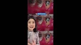 O que fazer com um PerioDonto como esses?