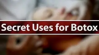 Botox - Fixes More than Just Wrinkles