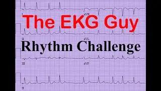 EKG/ECG - Rhythm Challenge 6.0 | The EKG Guy