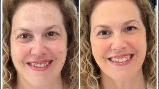 COMO CORREGIR LAS MANCHAS CON MAQUILLAJE (MELASMA, LENTIGOS). ANA APARICHI