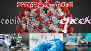 Rapid tes, ternyata!! Begini (suasana uji rapid tes di laboratorium)