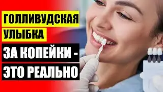😀 Купить виниры в интернет магазине