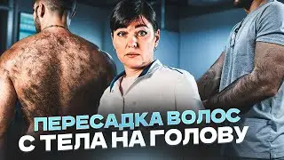 Пересадка волос с тела на голову