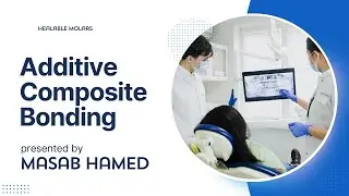 what if additive composite bonding is better than crowns?