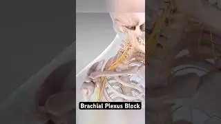 How Doctors Turn Off Arm Pain (Temporarily!)