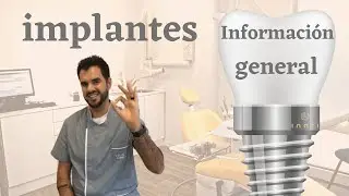 Informacion general sobre implantes