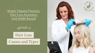 Hair Loss 101: Hair Loss Causes & Types