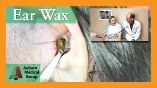 Ear Wax Removal for Hearing Aids | Auburn Medical Group