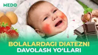 Bolalardagi diatezni davolash yo‘llari