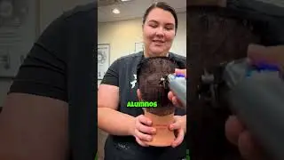 ¿Cómo disimular la calvicie frontal?😱