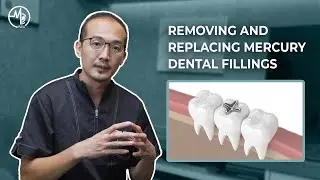 Mercury fillings: Should I remove and replace them?