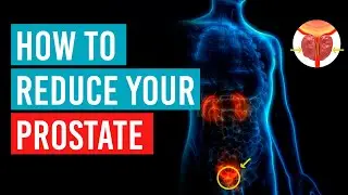 How to reduce your #prostate
