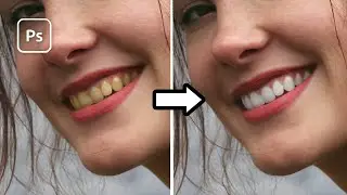 Como clarear os dentes no Photoshop?