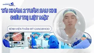 TÁI KHÁM 2 TUẦN SAU KHI ĐIỀU TRỊ LIỆT MẶT TẠI BVTM GANGWHOO