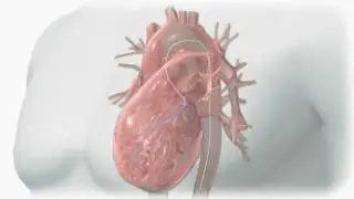 Preparing for a Cardiac Catheterization Procedure