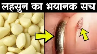 खाली पेट लहसुन खाने के बाद, देखिये आपके शरीर के साथ क्या होता है | शरीर बनेगा फौलाद