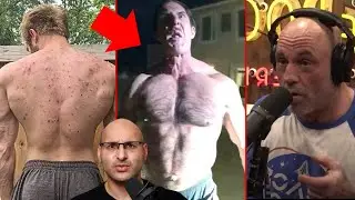 Bodybuilder has Roid Rage MELTDOWN