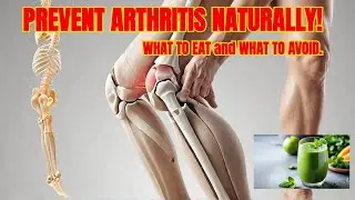 Prevent Arthritis Naturally: How To Make Your Joints Healthy Again