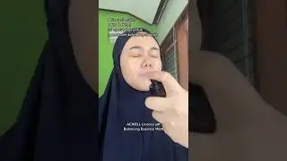 Rekomendasi Skincare Untuk Kulit Kombinasi dan Berminyak 💜