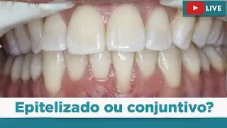 Como selecionar corretamente o tipo de enxerto?