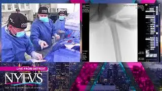 LIVE CASE PRESENTATION #6   SESSIONS IN CLTI   Broadcast From  Michigan Outpatient Vascular Institut
