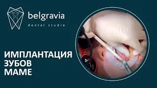 ​👩‍⚕️​👉​Имплантация зубов маме