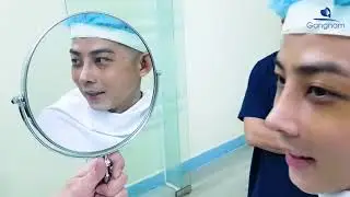 HÀNH TRÌNH LỘT XÁC NÂNG MŨI L LINE 4D - Thẩm mỹ viện Gangnam