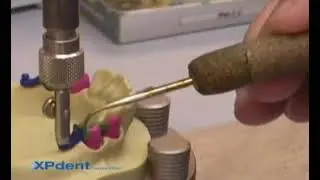 VKS-OC Attachment System