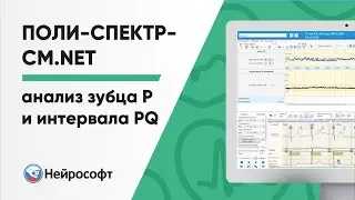 Анализ зубца P и интервала PQ в программе Поли-Спектр-СМ.NET