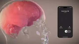 Neuralink’s Clinical Trial: The PRIME Study