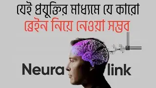 ব্রেইন ট্রান্সফারের যুগ চলে এসেছে || The era of brain transfer has arrived