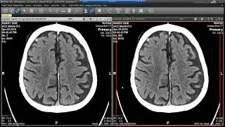 AI Based Decision Support with Universal Viewer